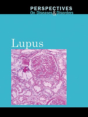 Lupus - Mitchell Haugen, Hayley (Editor)