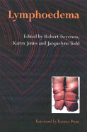Lymphoedema - Twycross, Robert (Editor), and Jenns, Karen (Editor), and Todd, Jacquelyne (Editor)