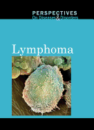 Lymphoma