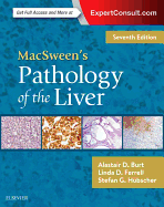 Macsween's Pathology of the Liver