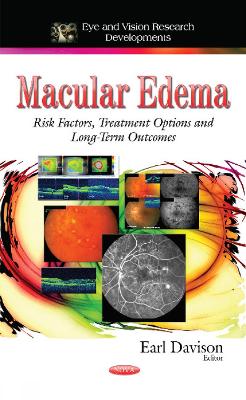 Macular Edema: Risk Factors, Treatment Options and Long-Term Outcomes - Davison, Earl (Editor)