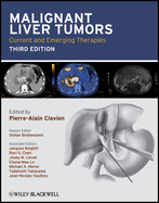 Malignant Liver Tumors: Current and Emerging Therapies: .