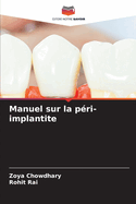 Manuel sur la p?ri-implantite