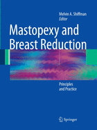 Mastopexy and Breast Reduction: Principles and Practice