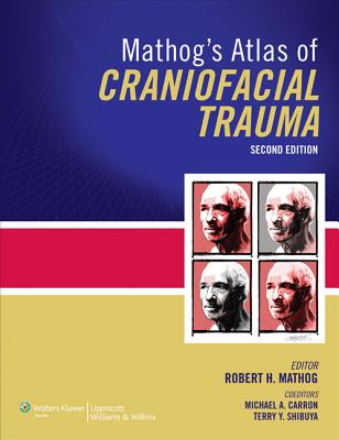 Mathog's Atlas of Craniofacial Trauma - Mathog, Robert H, MD, and Shibuya, Terry, Dr., and Carron, Michael A, Dr.