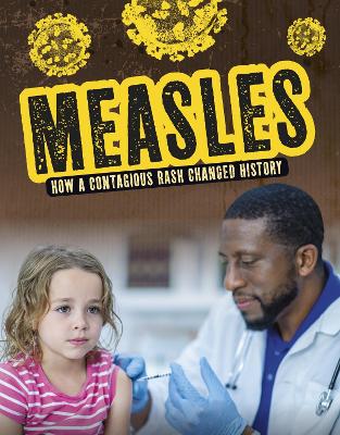 Measles: How a Contagious Rash Changed History - Lewis, Mark K.