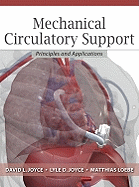Mechanical Circulatory Support: Principles and Applications