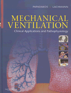 Mechanical Ventilation: Clinical Applications and Pathophysiology