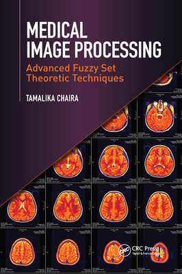 Medical Image Processing: Advanced Fuzzy Set Theoretic Techniques - Chaira, Tamalika