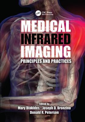 Medical Infrared Imaging: Principles and Practices - Diakides, Mary (Editor), and Bronzino, Joseph D. (Editor), and Peterson, Donald R. (Editor)