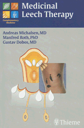 Medicinal Leech Therapy