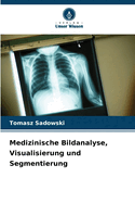 Medizinische Bildanalyse, Visualisierung und Segmentierung