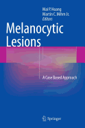 Melanocytic Lesions: A Case Based Approach