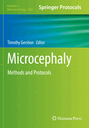 Microcephaly: Methods and Protocols