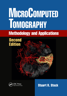Microcomputed Tomography: Methodology and Applications, Second Edition - Stock, Stuart R