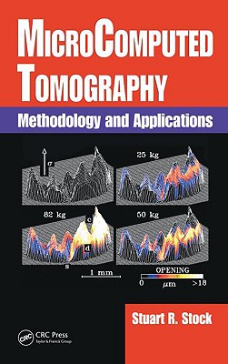 Microcomputed Tomography: Methodology and Applications - Stock, Stuart R