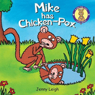 Mike has chicken pox