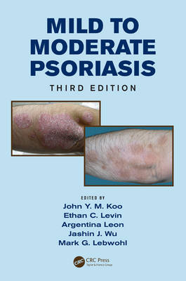Mild to Moderate Psoriasis - Koo, John (Editor), and Levin, Ethan (Editor), and Leon, Argentina (Editor)