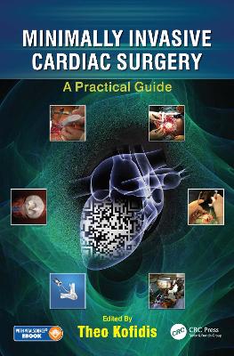 Minimally Invasive Cardiac Surgery: A Practical Guide - Kofidis, Theo (Editor)