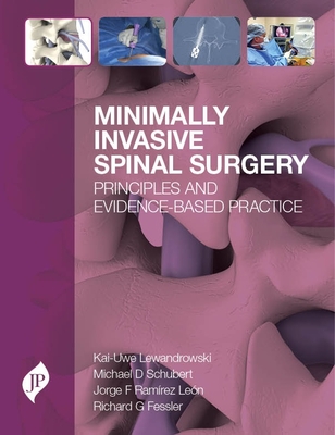 Minimally Invasive Spinal Surgery: Principles and Evidence-Based Practice - Lewandrowski, Kai-Uwe, and Schubert, Michael, and Ram�rez L�on, Jorge F