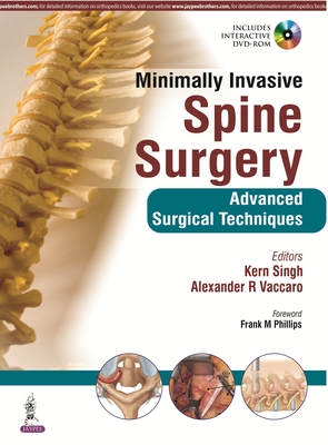 Minimally Invasive Spine Surgery - Singh, Kern, and Vaccaro, Alexander