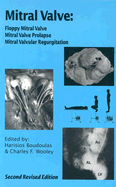 Mitral Valve: Flopyy Mitral Valve, Mitral Valve Prolapse, Mitral Valvular Regurgitation