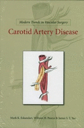 Modern Trends in Vascular Surgery: Carotid Artery Disease