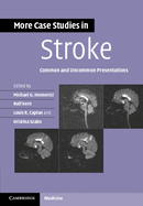 More Case Studies in Stroke: Common and Uncommon Presentations