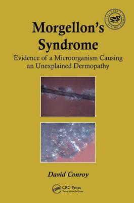 Morgellon's Syndrome - Conroy, David