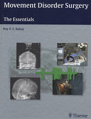 Movement Disorder Surgery: The Essentials - Bakay, Roy Ae (Editor)