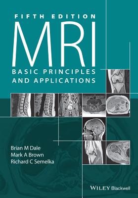 MRI: Basic Principles and Applications - Dale, Brian M., and Brown, Mark A., and Semelka, Richard C.