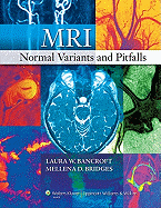 MRI Normal Variants and Pitfalls