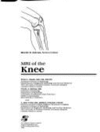 MRI of the Knee