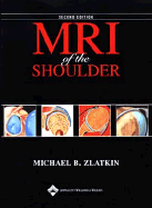 MRI of the Shoulder