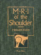 MRI of the Shoulder