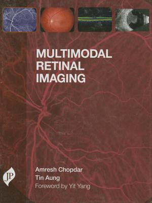 Multimodal Retinal Imaging - Chopdar, Amresh, and Aung, Tin