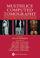 Multislice Computed Tomography: Principles, Practice, and Clinical Protocols - Time-Life Books, and Silverman, Paul M, MD (Editor)