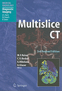 Multislice CT