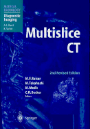 Multislice CT