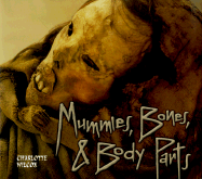 Mummies, Bones, and Body Parts