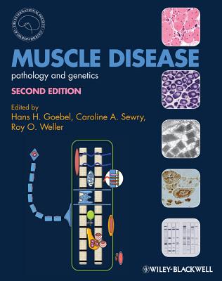 Muscle Disease: Pathology and Genetics - Goebel, Hans H. (Editor), and Sewry, Caroline A. (Editor), and Weller, Roy O. (Editor)