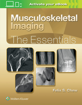 Musculoskeletal Imaging: The Essentials - Chew, Felix S, MD