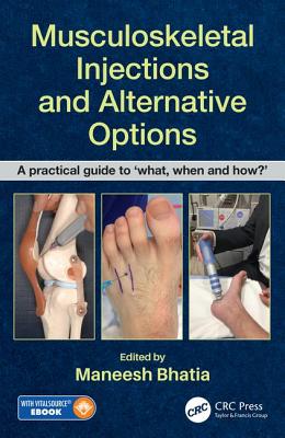 Musculoskeletal Injections and Alternative Options: A practical guide to 'what, when and how?' - Bhatia, Maneesh (Editor)