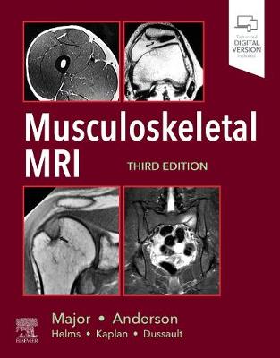 Musculoskeletal MRI - Major, Nancy M., MD, and Anderson, Mark W., MD