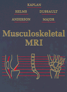 Musculoskeletal MRI