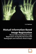 Mutual Information-Based Image Registration