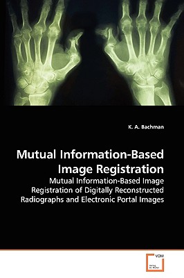 Mutual Information-Based Image Registration - Bachman, K A