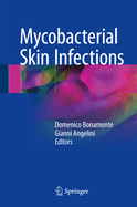 Mycobacterial Skin Infections