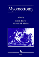Myomectomy