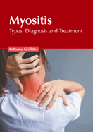 Myositis: Types, Diagnosis and Treatment